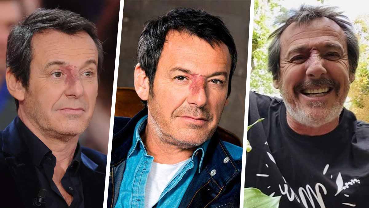 Jean-Luc Reichmann : découvrez la métamorphose physique de la star de TF1 tout au long de sa carrière !